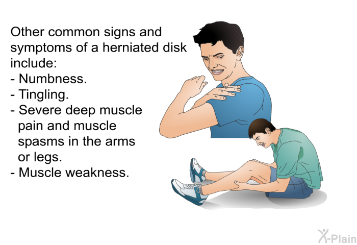 Other common signs and symptoms of a herniated disk include:  Numbness. Tingling. Severe deep muscle pain and muscle spasms in the arms or legs. Muscle weakness.