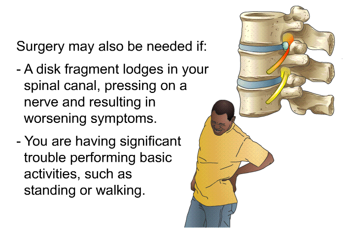 Surgery may also be needed if:  A disk fragment lodges in your spinal canal, pressing on a nerve and resulting in worsening symptoms. You are having significant trouble performing basic activities, such as standing or walking.