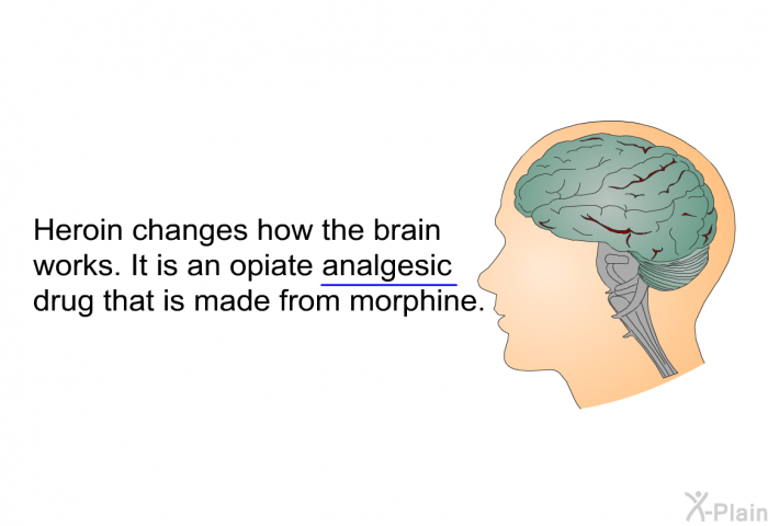 Heroin changes how the brain works. It is an opiate analgesic drug that is made from morphine.