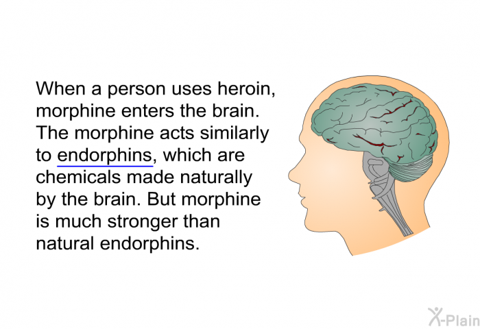 When a person uses heroin, morphine enters the brain. The morphine acts similarly to endorphins, which are chemicals made naturally by the brain. But morphine is much stronger than natural endorphins.