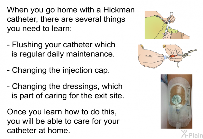 When you go home with a Hickman catheter, there are several things you need to learn:  Flushing your catheter which is regular daily maintenance. Changing the injection cap. Changing the dressings, which is part of caring for the exit site.  
 Once you learn how to do this, you will be able to care for your catheter at home.