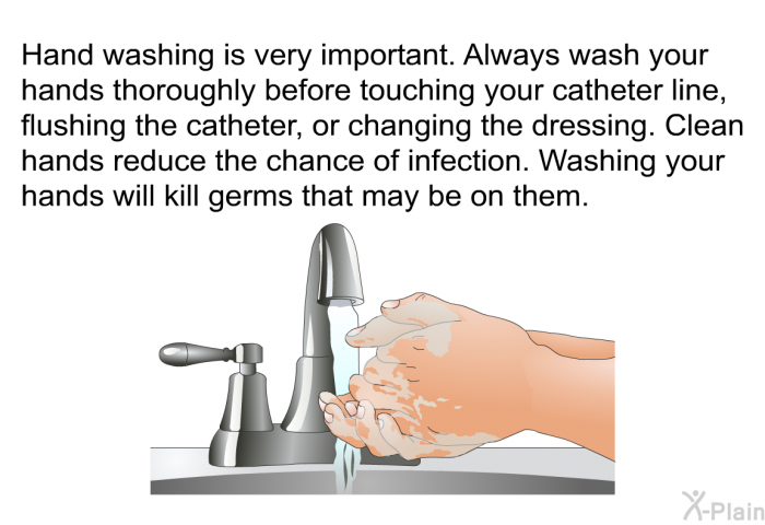 Hand washing is very important. Always wash your hands thoroughly before touching your catheter line, flushing the catheter, or changing the dressing. Clean hands reduce the chance of infection. Washing your hands will kill germs that may be on them.