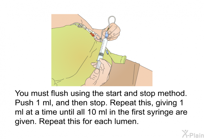 You must flush using the start and stop method. Push 1 ml, and then stop. Repeat this, giving 1 ml at a time until all 10 ml in the first syringe are given. Repeat this for each lumen.
