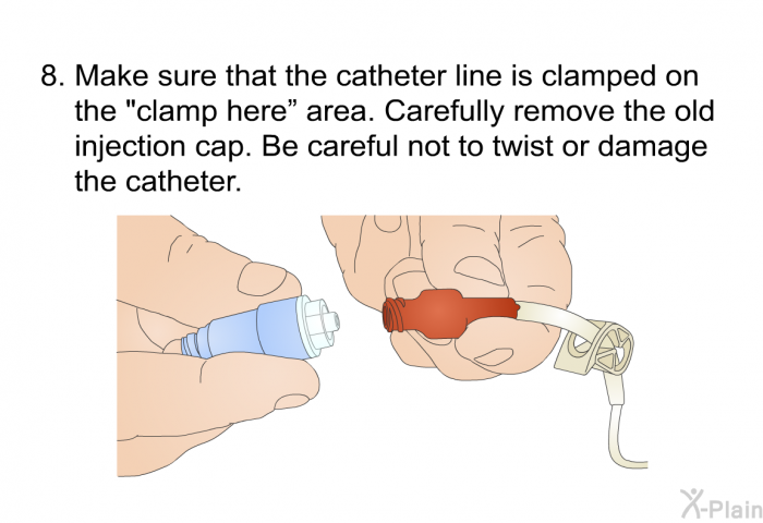 Make sure that the catheter line is clamped on the "clamp here&rdquo; area. Carefully remove the old injection cap. Be careful not to twist or damage the catheter.