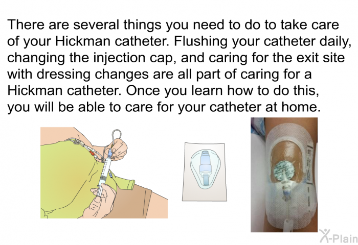 There are several things you need to do to take care of your Hickman catheter. Flushing your catheter daily, changing the injection cap, and caring for the exit site with dressing changes are all part of caring for a Hickman catheter. Once you learn how to do this, you will be able to care for your catheter at home.