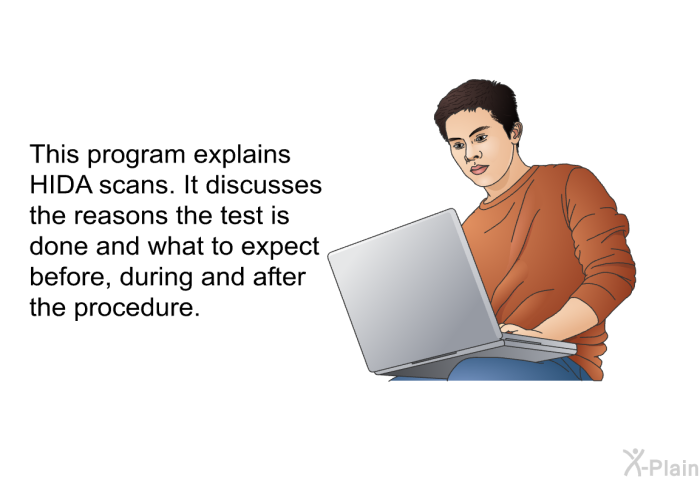 This health information explains HIDA scans. It discusses the reasons the test is done and what to expect before, during and after the procedure.