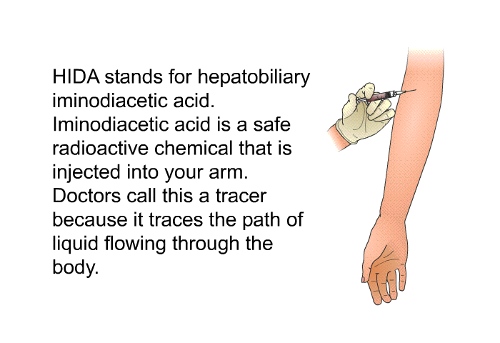 HIDA stands for hepatobiliary iminodiacetic acid. Iminodiacetic acid is a safe radioactive chemical that is injected into your arm. Doctors call this a tracer because it traces the path of liquid flowing through the body.
