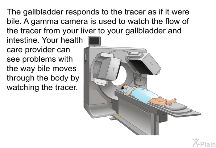 The gallbladder responds to the tracer as if it were bile. A gamma camera is used to watch the flow of the tracer from your liver to your gallbladder and intestine. Your health care provider can see problems with the way bile moves through the body by watching the tracer.