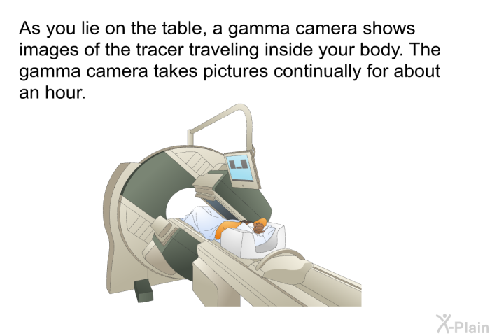 As you lie on the table, a gamma camera shows images of the tracer traveling inside your body. The gamma camera takes pictures continually for about an hour.