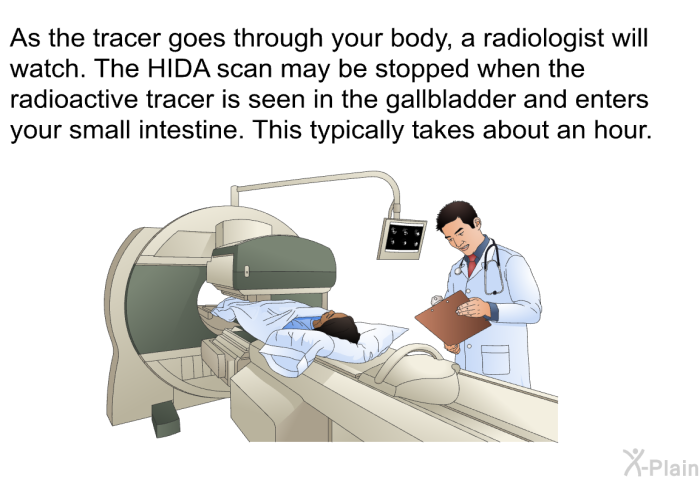 As the tracer goes through your body, a radiologist will watch. The HIDA scan may be stopped when the radioactive tracer is seen in the gallbladder and enters your small intestine. This typically takes about an hour.