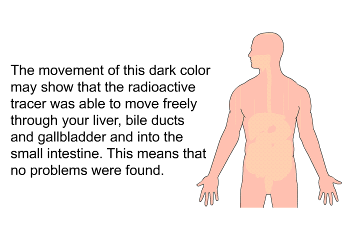 The movement of this dark color may show that the radioactive tracer was able to move freely through your liver, bile ducts and gallbladder and into the small intestine. This means that no problems were found.