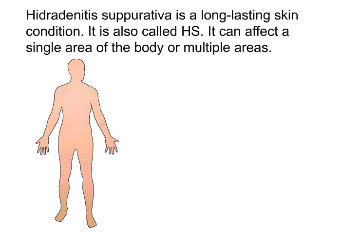 Hidradenitis suppurativa is a long-lasting skin condition. It is also called HS. It can affect a single area of the body or multiple areas.