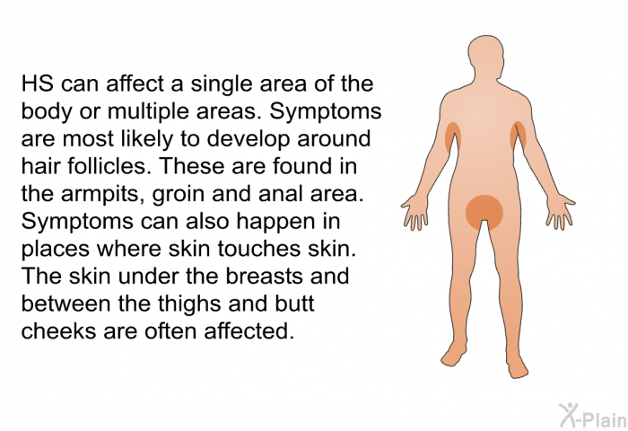 HS can affect a single area of the body or multiple areas. Symptoms are most likely to develop around hair follicles. These are found in the armpits, groin and anal area. Symptoms can also happen in places where skin touches skin. The skin under the breasts and between the thighs and butt cheeks are often affected.