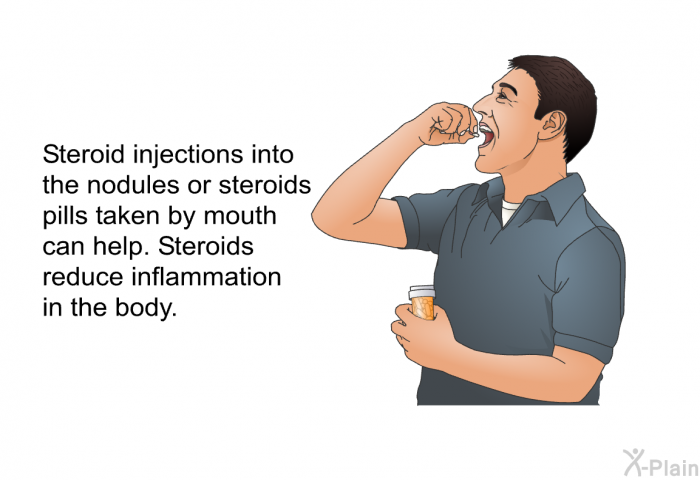 Steroid injections into the nodules or steroids pills taken by mouth can help. Steroids reduce inflammation in the body.