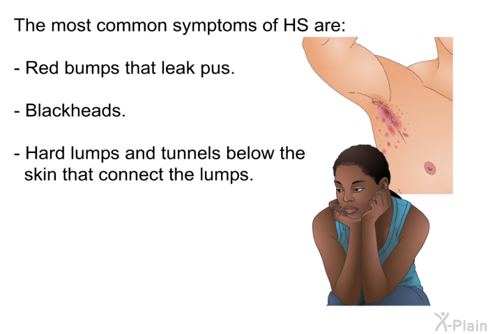 The most common symptoms of HS are:  Red bumps that leak pus. Blackheads.   Hard lumps and tunnels below the skin that connect the lumps.