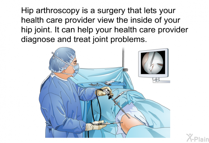 Hip arthroscopy is a surgery that lets your health care provider view the inside of your hip joint. It can help your health care provider diagnose and treat joint problems.