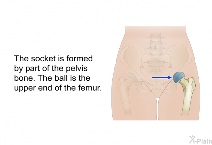 The socket is formed by part of the pelvis bone. The ball is the upper end of the femur.