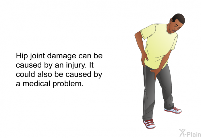 Hip joint damage can be caused by an injury. It could also be caused by a medical problem.