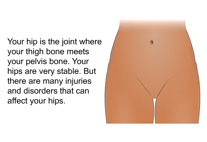 Your hip is the joint where your thigh bone meets your pelvis bone. Your hips are very stable. But there are many injuries and disorders that can affect your hips.