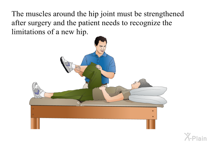 Hip Replacement Physical Therapy