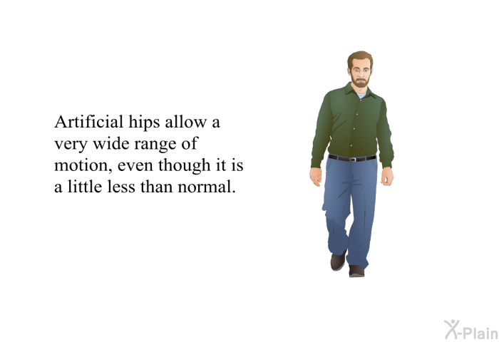 Artificial hips allow a very wide range of motion, even though it is a little less than normal.