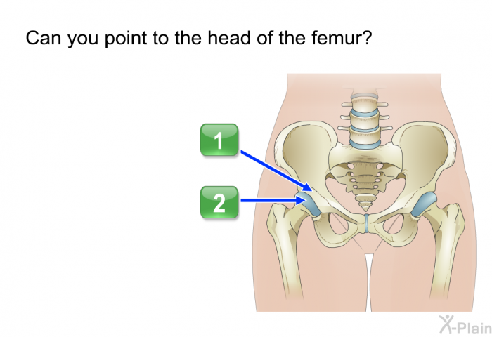 Can you point to the head of the femur?