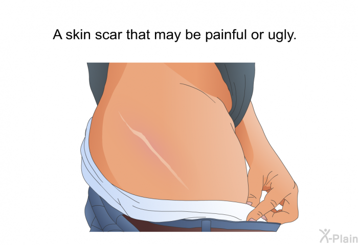 A skin scar that may be painful or ugly.