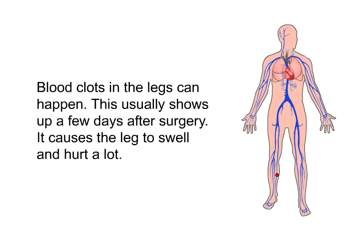 Blood clots in the legs can happen. This usually shows up a few days after surgery. It causes the leg to swell and hurt a lot.