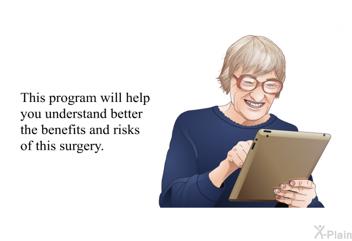 This health information will help you understand better the benefits and risks of this surgery.