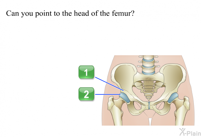 Can you point to the head of the femur?