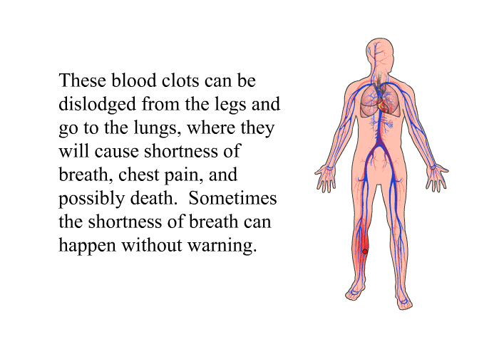 These blood clots can be dislodged from the legs and go to the lungs, where they will cause shortness of breath, chest pain, and possibly death. Sometimes the shortness of breath can happen without warning.