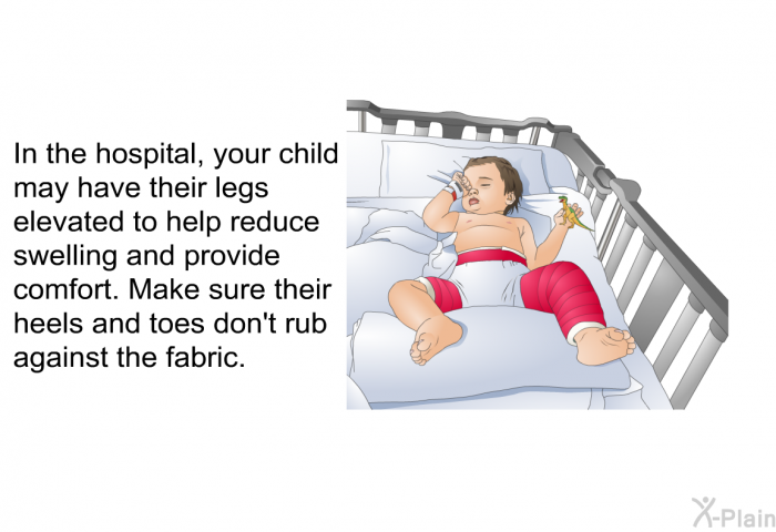 In the hospital, your child may have their legs elevated to help reduce swelling and provide comfort. Make sure their heels and toes don't rub against the fabric.
