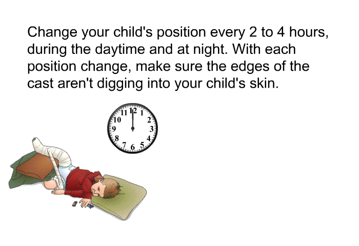 Change your child's position every 2 to 4 hours, during the daytime and at night. With each position change, make sure the edges of the cast aren't digging into your child's skin.