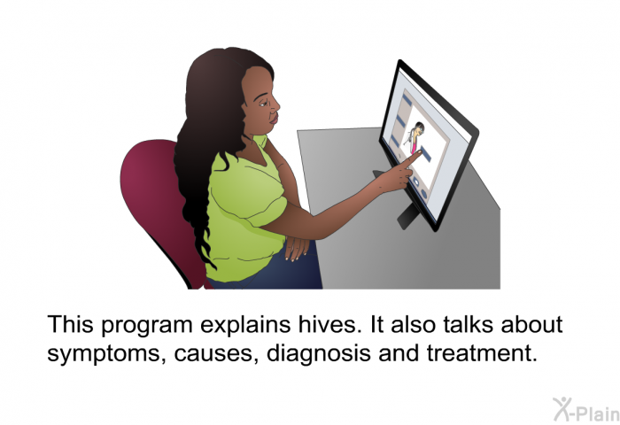 This health information explains hives. It also talks about symptoms, causes, diagnosis and treatment.