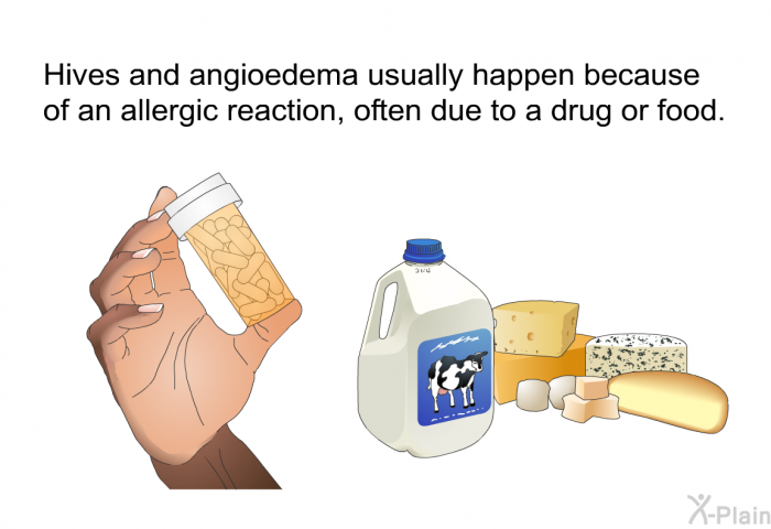 Hives and angioedema usually happen because of an allergic reaction, often due to a drug or food.