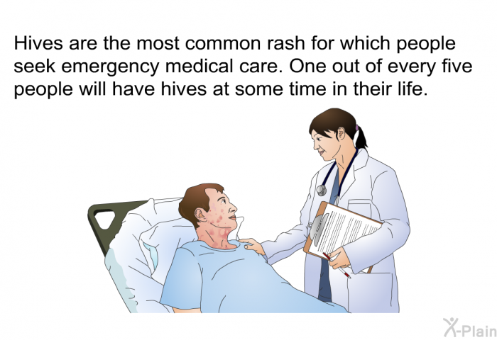 Hives are the most common rash for which people seek emergency medical care. One out of every five people will have hives at some time in their life.