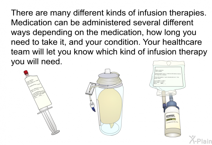 There are many different kinds of infusion therapies. Medication can be administered several different ways depending on the medication, how long you need to take it, and your condition. Your healthcare team will let you know which kind of infusion therapy you will need.