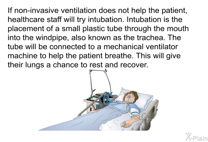 If non-invasive ventilation does not help the patient, healthcare staff will try intubation. Intubation is the placement of a small plastic tube through the mouth into the windpipe, also known as the trachea. The tube will be connected to a mechanical ventilator machine to help the patient breathe. This will give their lungs a chance to rest and recover.