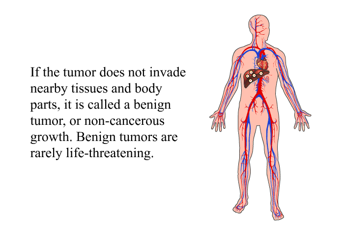 If the tumor does not invade nearby tissues and body parts, it is called a benign tumor, or non-cancerous growth. Benign tumors are rarely life-threatening.