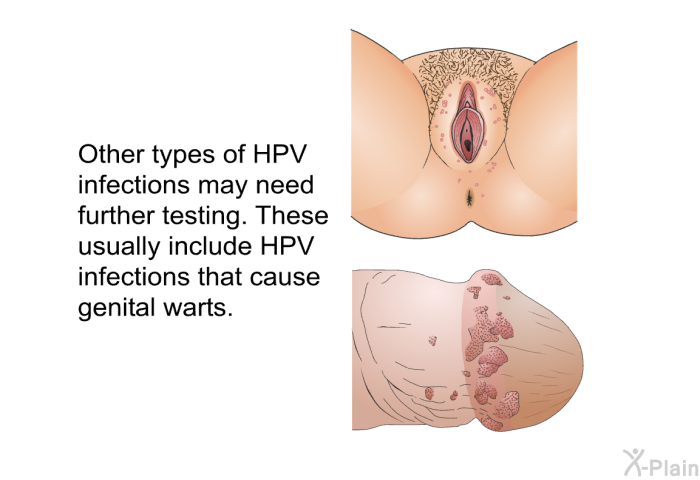 Other types of HPV infections may need further testing. These usually include HPV infections that cause genital warts.