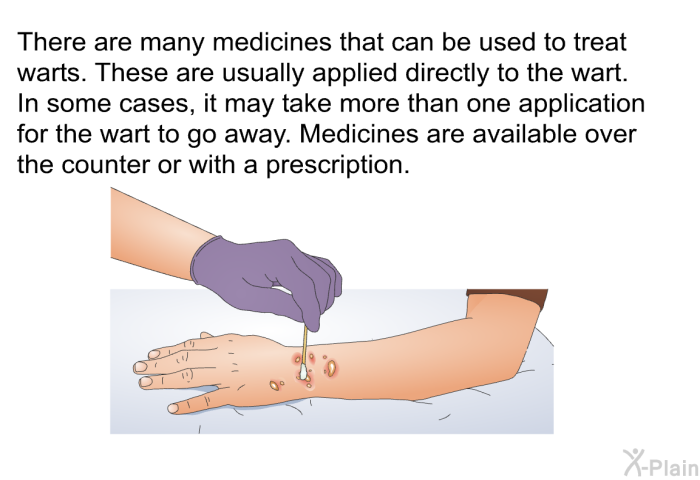 There are many medicines that can be used to treat warts. These are usually applied directly to the wart. In some cases, it may take more than one application for the wart to go away. Medicines are available over the counter or with a prescription.