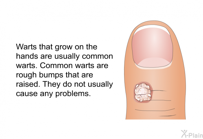 Warts that grow on the hands are usually common warts. Common warts are rough bumps that are raised. They do not usually cause any problems.