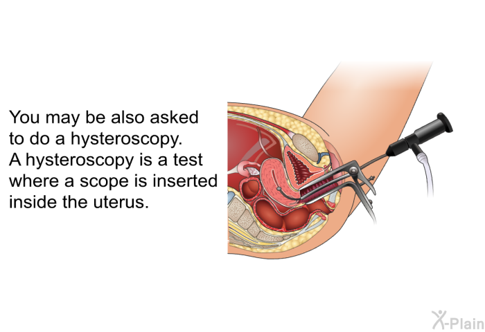 You may be also asked to do a hysteroscopy. A hysteroscopy is a test where a scope is inserted inside the uterus.