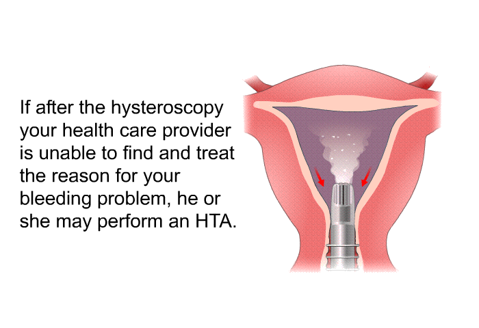 If after the hysteroscopy your health care provider is unable to find and treat the reason for your bleeding problem, he or she may perform an HTA.