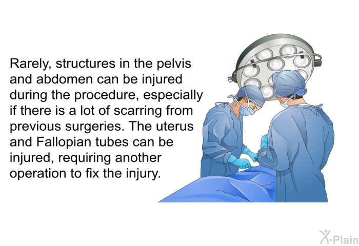Rarely, structures in the pelvis and abdomen can be injured during the procedure, especially if there is a lot of scarring from previous surgeries. The uterus and Fallopian tubes can be injured, requiring another operation to fix the injury.