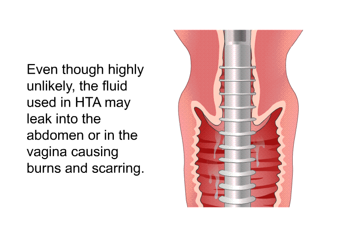 Even though highly unlikely, the fluid used in HTA may leak into the abdomen or in the vagina causing burns and scarring.