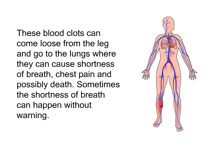 These blood clots can come loose from the leg and go to the lungs where they can cause shortness of breath, chest pain and possibly death. Sometimes the shortness of breath can happen without warning.