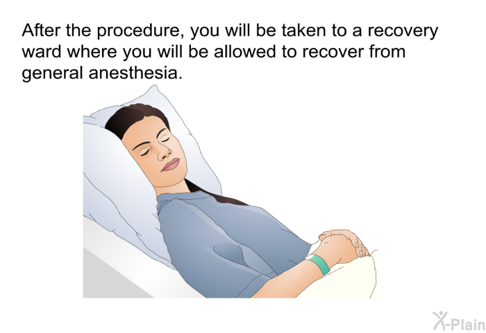 After the procedure, you will be taken to a recovery ward where you will be allowed to recover from general anesthesia.