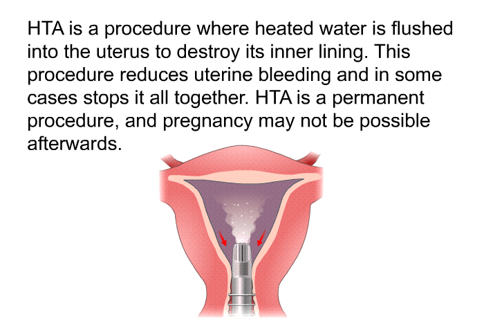 HTA is a procedure where heated water is flushed into the uterus to destroy its inner lining. This procedure reduces uterine bleeding and in some cases stops it all together. HTA is a permanent procedure, and pregnancy may not be possible afterwards.