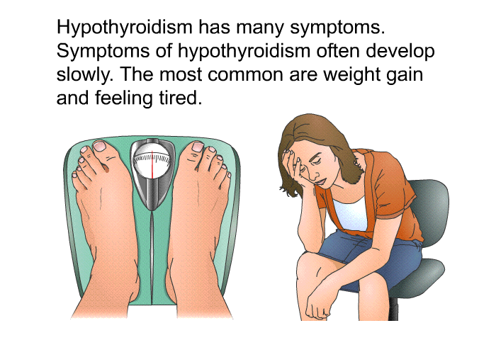 Hypothyroidism has many symptoms. Symptoms of hypothyroidism often develop slowly. The most common are weight gain and feeling tired.